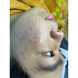 Sữa rửa mặt mầm gạo