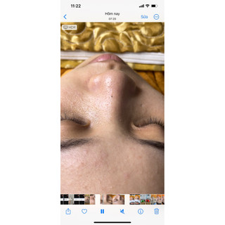 Sữa rửa mặt mầm gạo