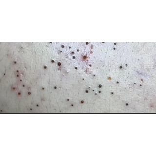 Sữa rửa mặt mầm gạo