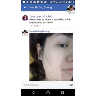 Sữa rửa mặt mầm gạo