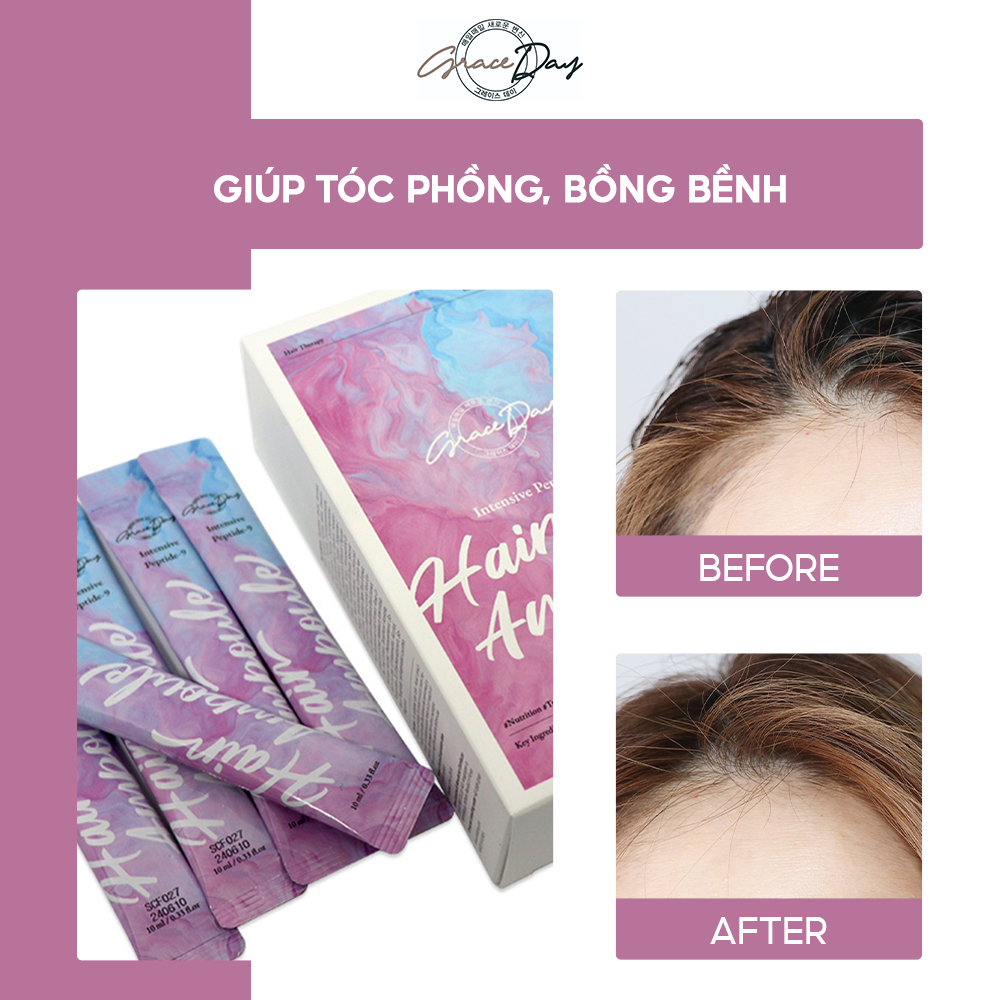 Tinh Chất Dưỡng Tóc GRACE DAY HAIR AMPOULE 10ML X 20EA INTENSIVE PEPTIDE-9