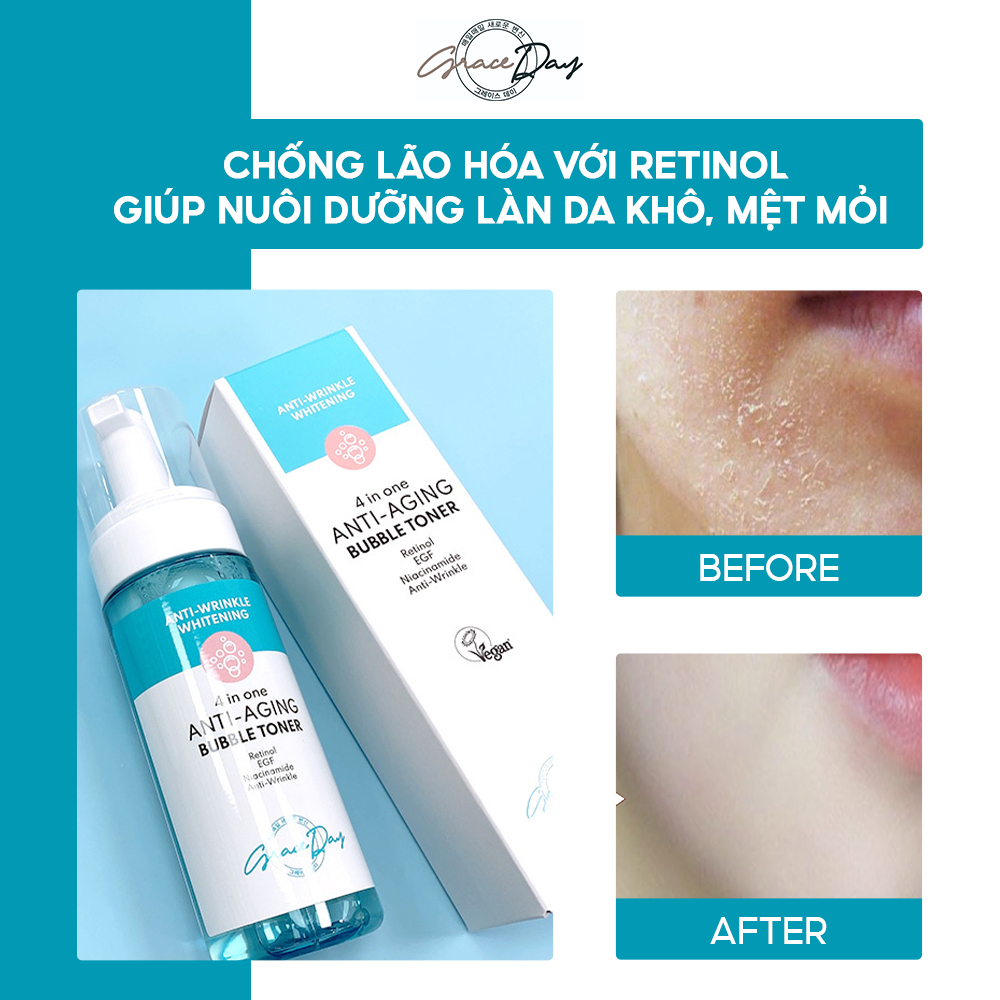 Nước Hoa Hồng Dạng Bọt GRACEDAY 4 IN ONE ACNE BUBBLE TONER