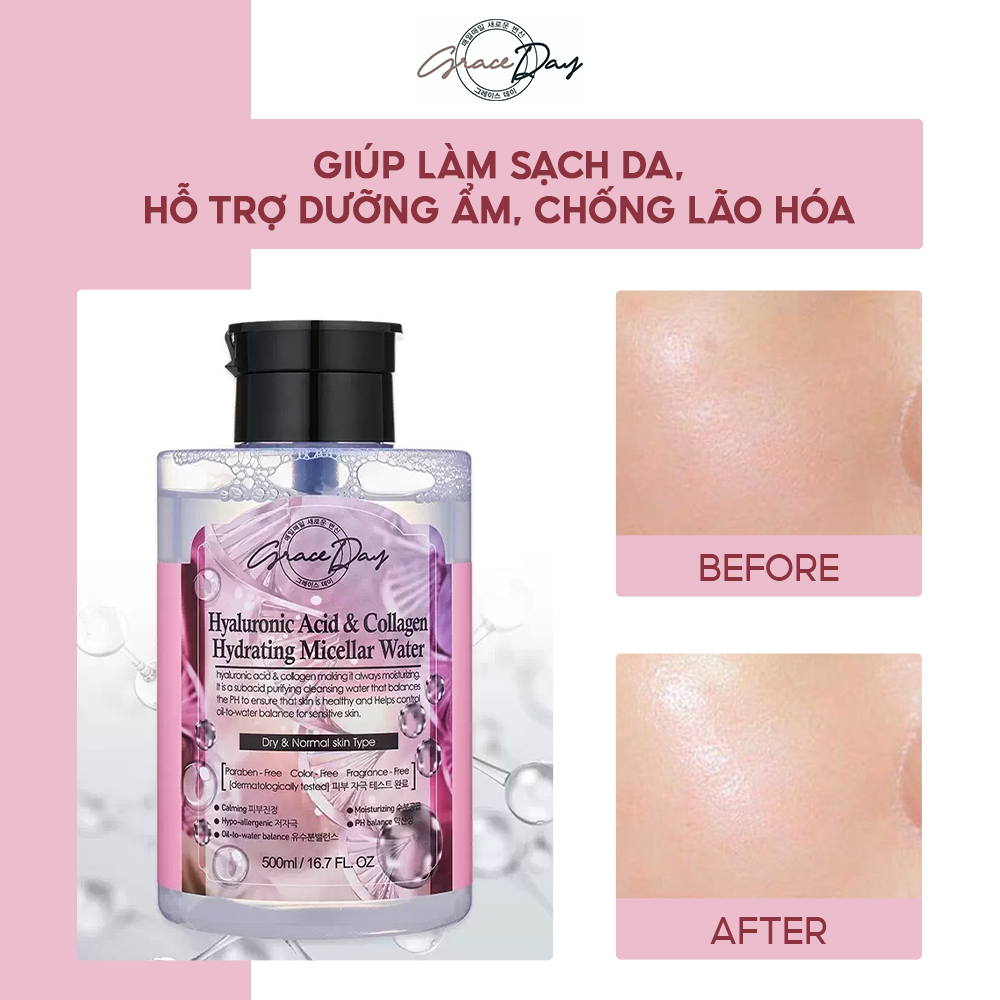 Nước Tẩy Trang Grace Day Hypoallergenic Micellar Cleansing Water