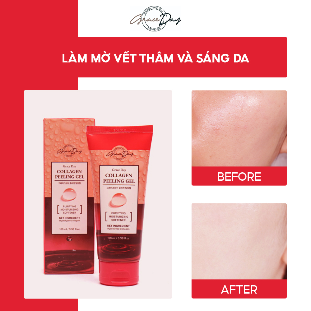 Gel Tẩy Tế Bào Chết GRACEDAY PEELING GEL 4 100ml