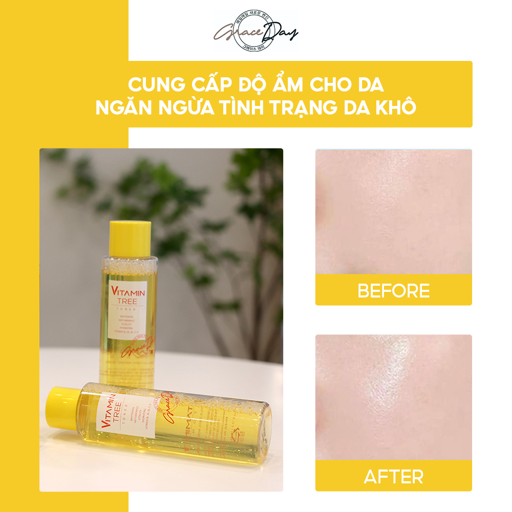 Nước Hoa Hồng Dưỡng Da Grace Day Vitamin Tree 150ml