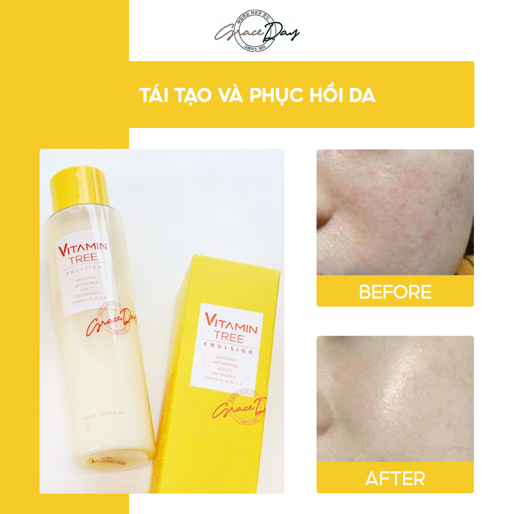 Sữa Dưỡng Da GRACEDAY VITAMIN TREE EMULSION 150ml