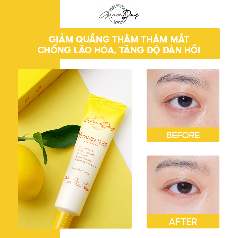 Kem Dưỡng Da Mắt GRACEDAY VITAMIN EYE CREAM 30ml