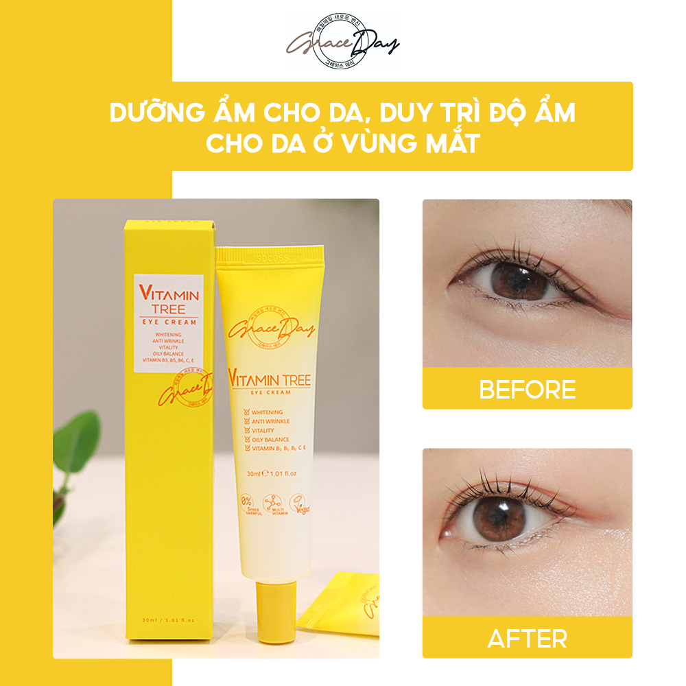 Kem Dưỡng Da Mắt GRACEDAY VITAMIN EYE CREAM 30ml