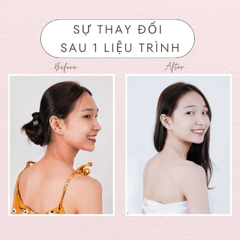 GLUTATHIONE 18000mg Viên Uống Trắng Da Cấp Tốc Giảm Nám Mờ Thâm Nhăn Căng Bóng Tăng Sinh Lý Nữ