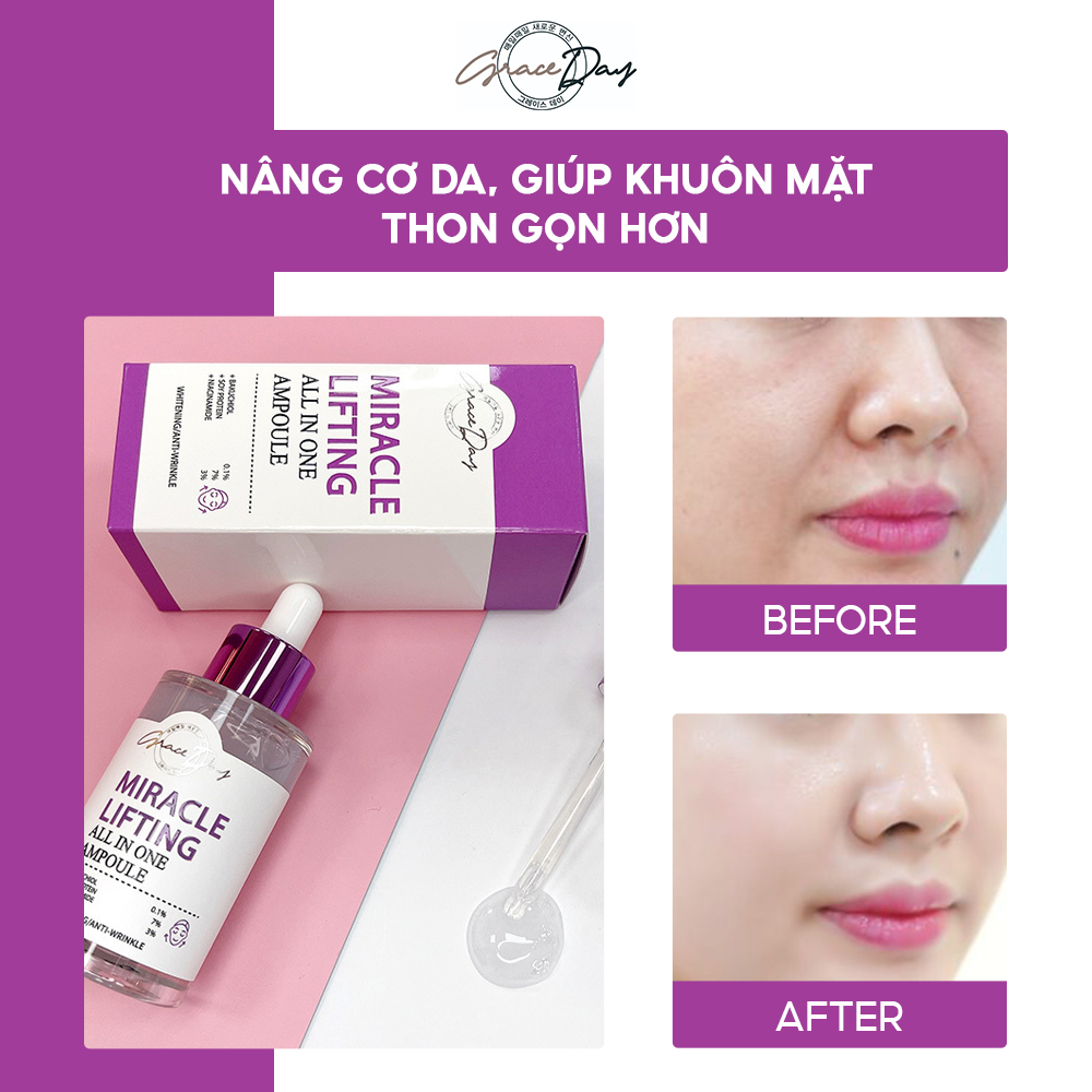 Tinh Chất Dưỡng Da GRACEDAY ALL IN ONE AMPOULE 50ml