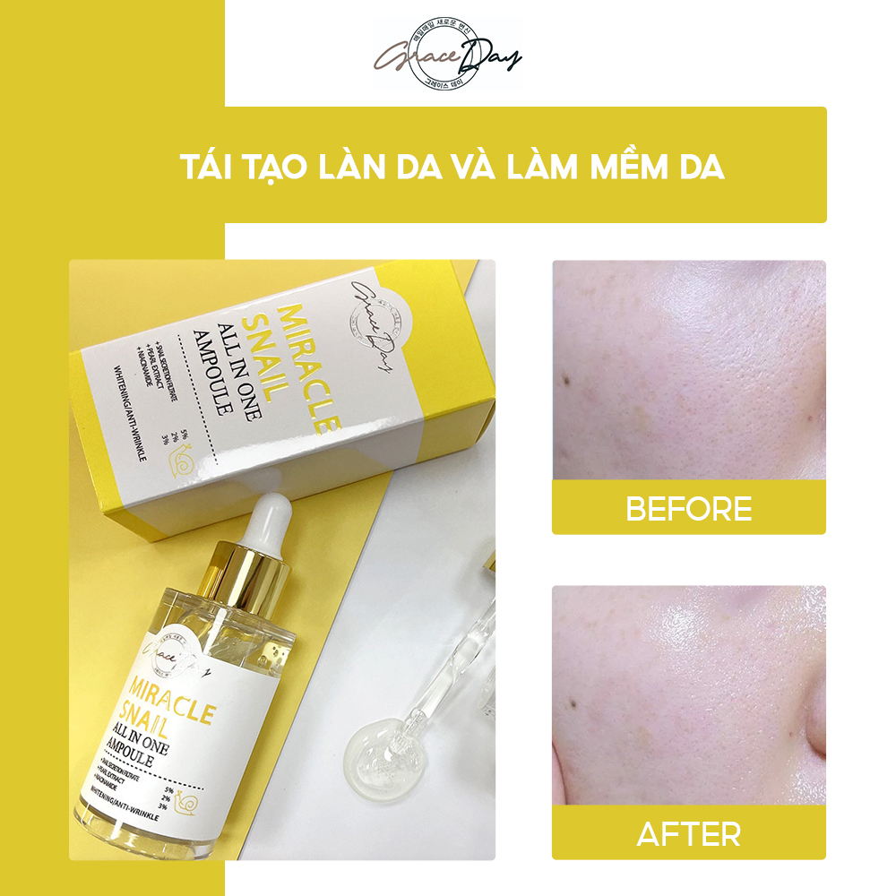 Tinh Chất Dưỡng Da GRACEDAY ALL IN ONE AMPOULE 50ml