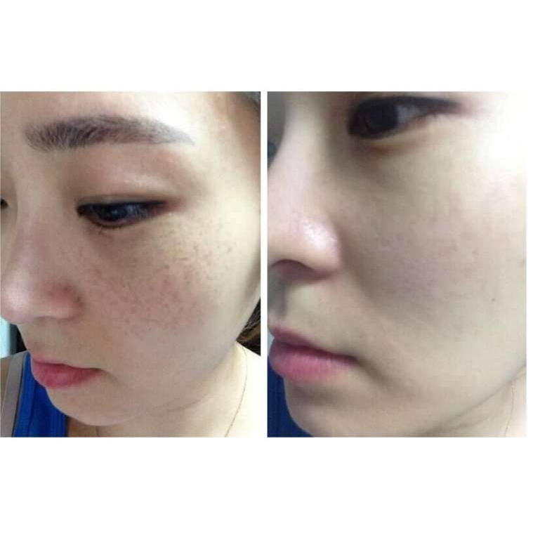 Viên Uống Trắng Da Mờ Nám Giảm Nếp Nhăn Glutathione 1000mg