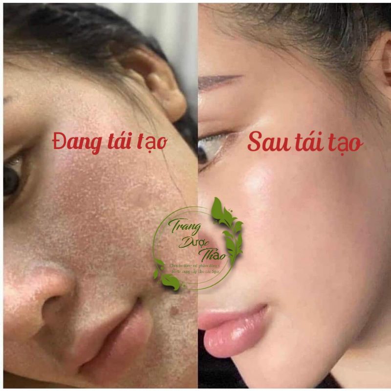 Kem sâm tươi tái tạo da handmade dùng cho da nám  20g