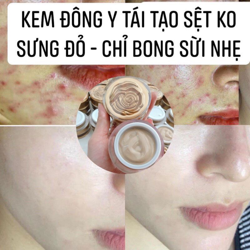 Kem sâm tươi tái tạo da handmade dùng cho da nám  20g