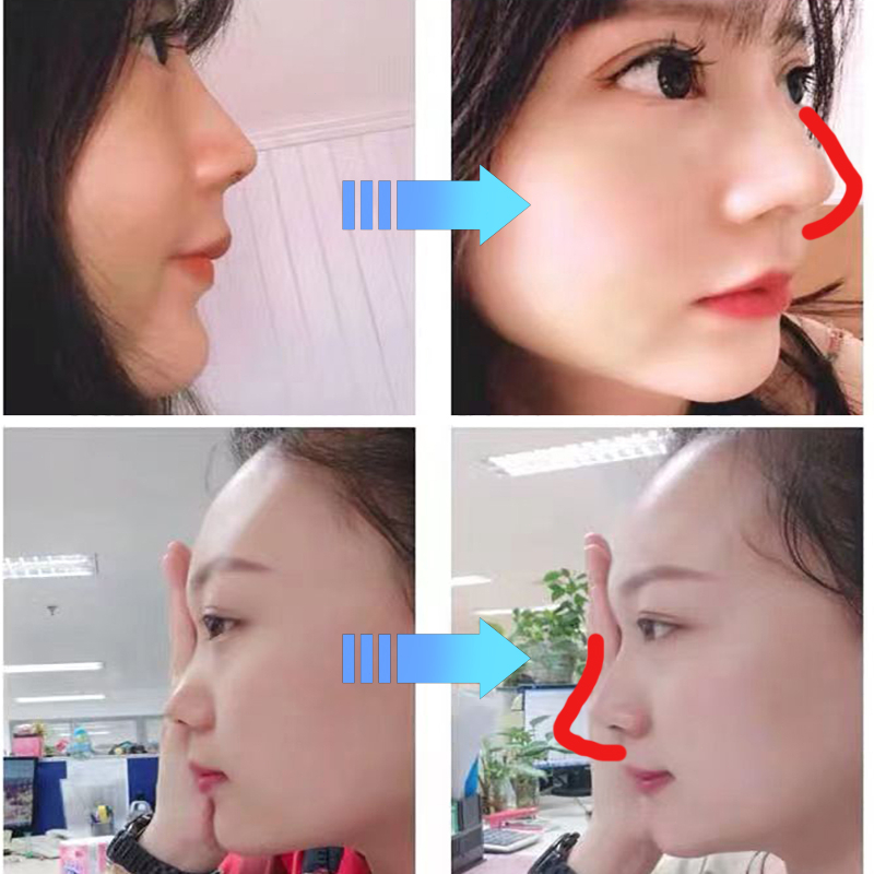 Serum cao mũi Tinh dầu nâng mũi Tinh dầu ũi Sụn nâ Định hình mũi 10ml Thu nhỏ cánh mũi Nâng sống mũi