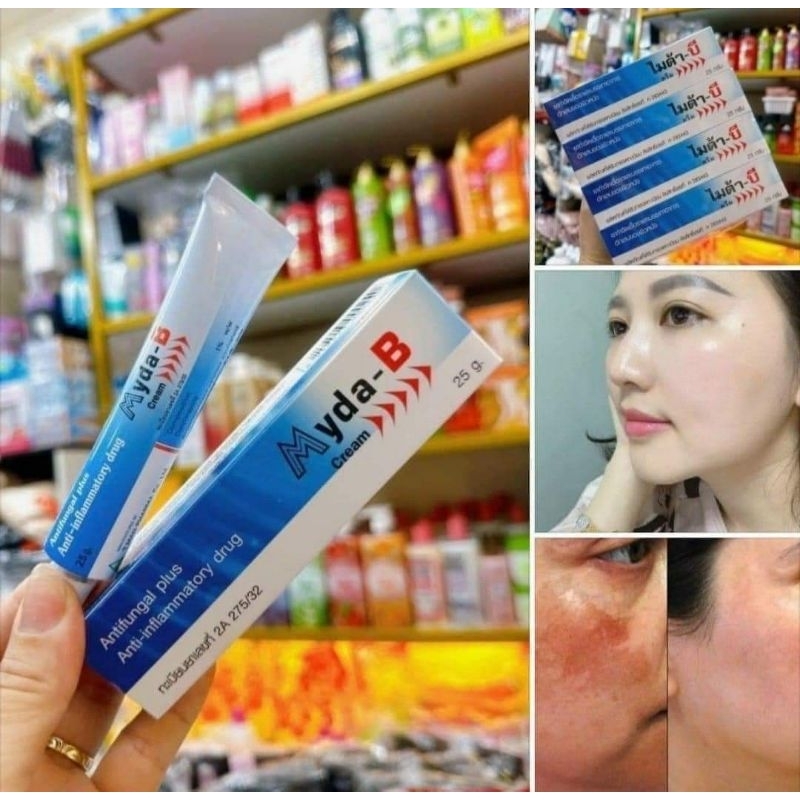 Kem bôi Nám MYDA-B Thái Lan