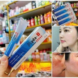Kem bôi Nám MYDA-B Thái Lan