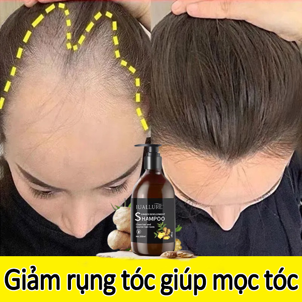 Dầu gội đầu Dầu gội gừng 200g Giảm rụng tóc Loại bỏ dầu tóc và gàu Chống ngứa da đầu Nuôi dưỡng da đầu để giúp mọc tóc