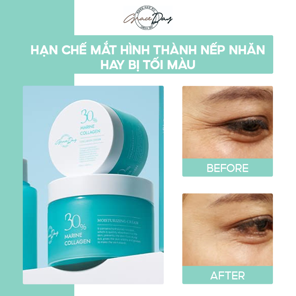 Kem Dưỡng Da Mắt GRACEDAY MARINE COLLAGEN DARK CIRCLE EYE CREAM 30ml