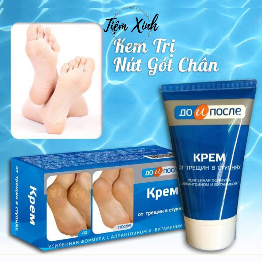 Kem nẻ gót chân Kpem Foot Cream giảm nẻ chân, nứt chân, khô da chân, dưỡng gót chân