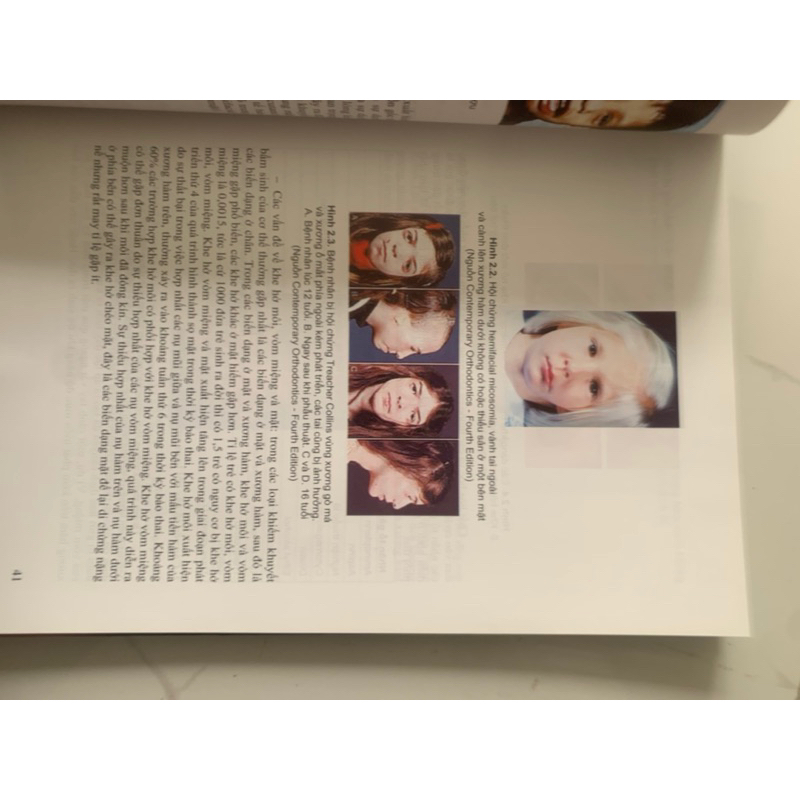 Sách - Chỉnh hình răng hàm mặt cơ bản