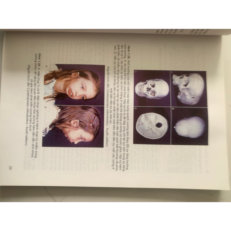 Sách - Chỉnh hình răng hàm mặt cơ bản