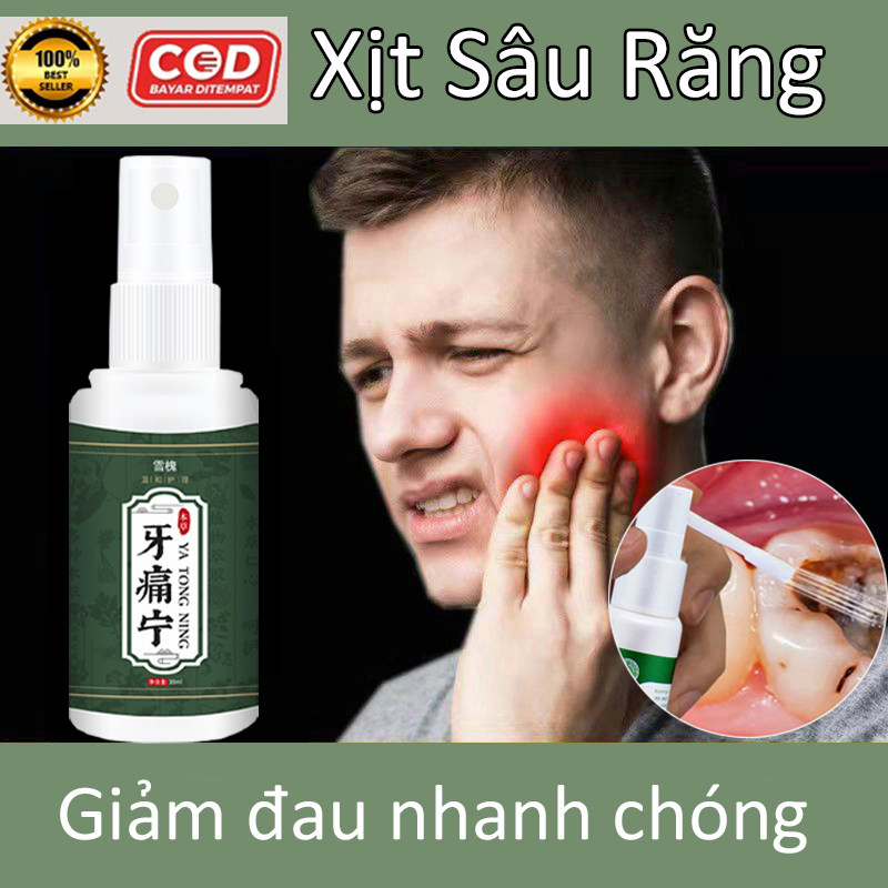 Xịt đau răng 30ml Xịt Giảm Đau Răng Sâu răng Làm dịu mát khi bị sâu răng, viêm nướu, viêm lợi,hôi miêng,Chăm sóc răng