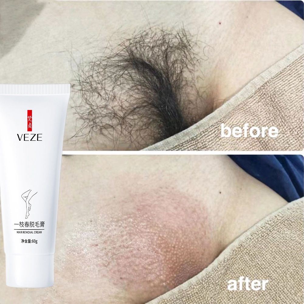 Kem tẩy lông cho da nhạy cảm 60g an toàn không đau rát Triệt Lông vùng chân tay nách và ​bikini nam nữ có t