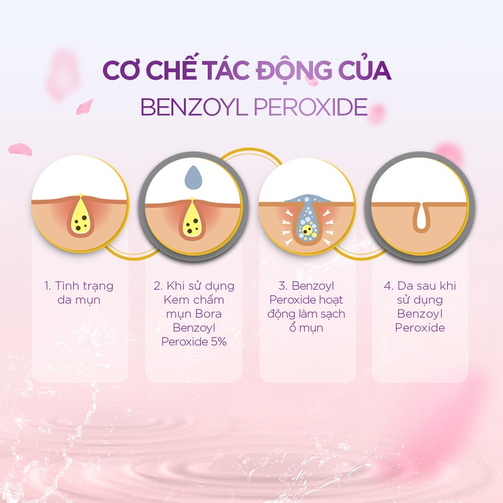 COMBO 4 Kem Chấm Mụn BORA BENZOYL PEROXIDE 5% Tẩy Tế Bào Chết Nhanh Chóng Làm Lành Vết Sẹo Tuýp 15g