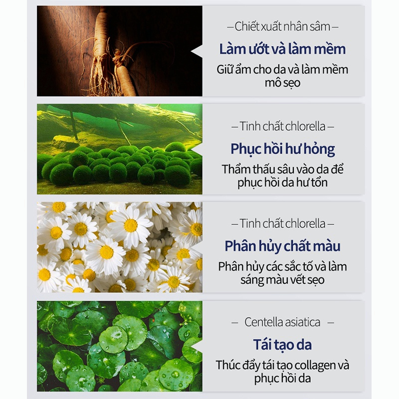 Kem xóa sẹo Kem sẹo Scar Care 50g sẹo do bị thương sẹo bỏng sẹo phẫu thuật sửa chữa tất cả