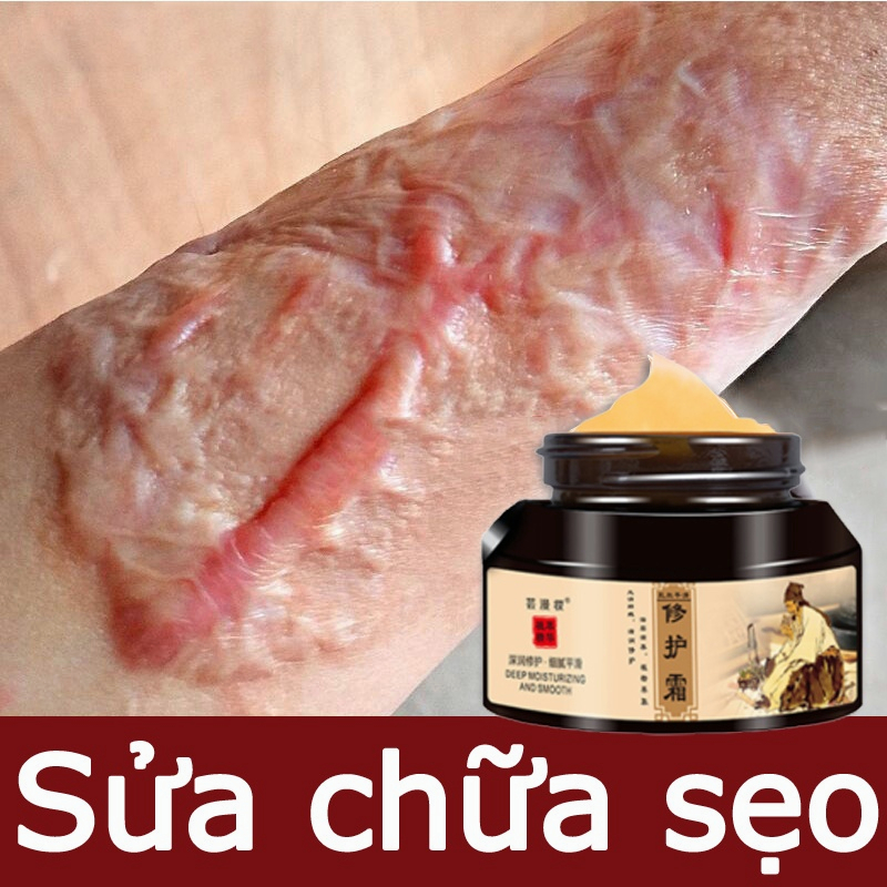 Kem xóa sẹo Kem sẹo Scar Care 50g sẹo do bị thương sẹo bỏng sẹo phẫu thuật sửa chữa tất cả