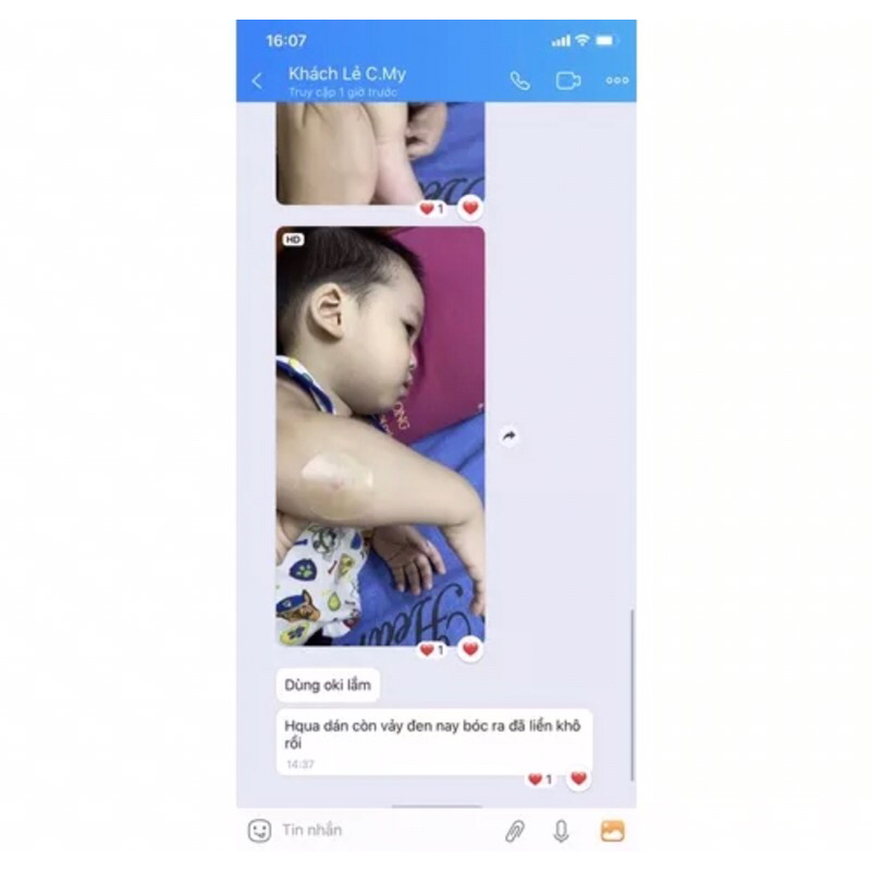 Miếng dán hút dịch chống loét DUO-SKIN Hydrocolloid dressing  10x10cm