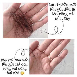 Cặp dầu GỘI XẢ BIOTIN tím