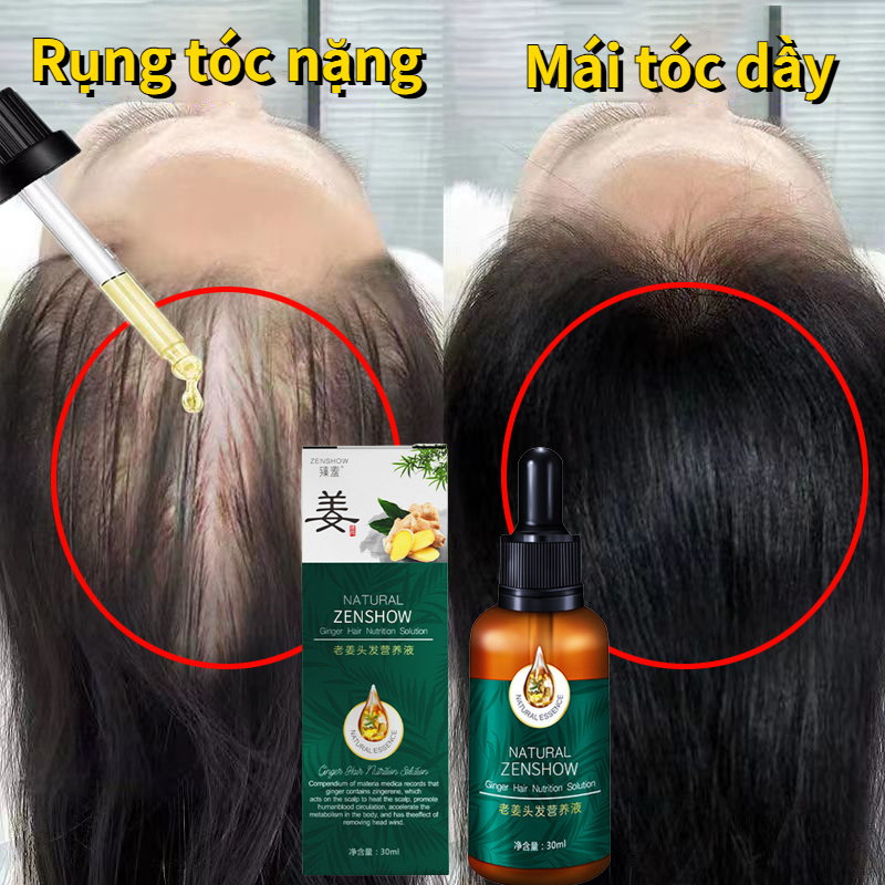 Serum mọc tóc tinh chất mọc tóc 30ml Chống rụng tóc sửa chữa nang tóc chiết xuất thức vật không gây kích ứng