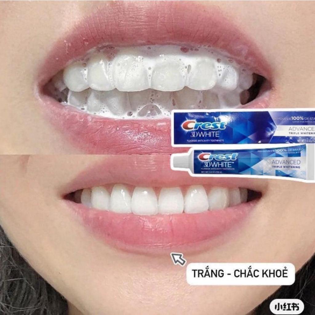 Kem Đánh Răng Crest