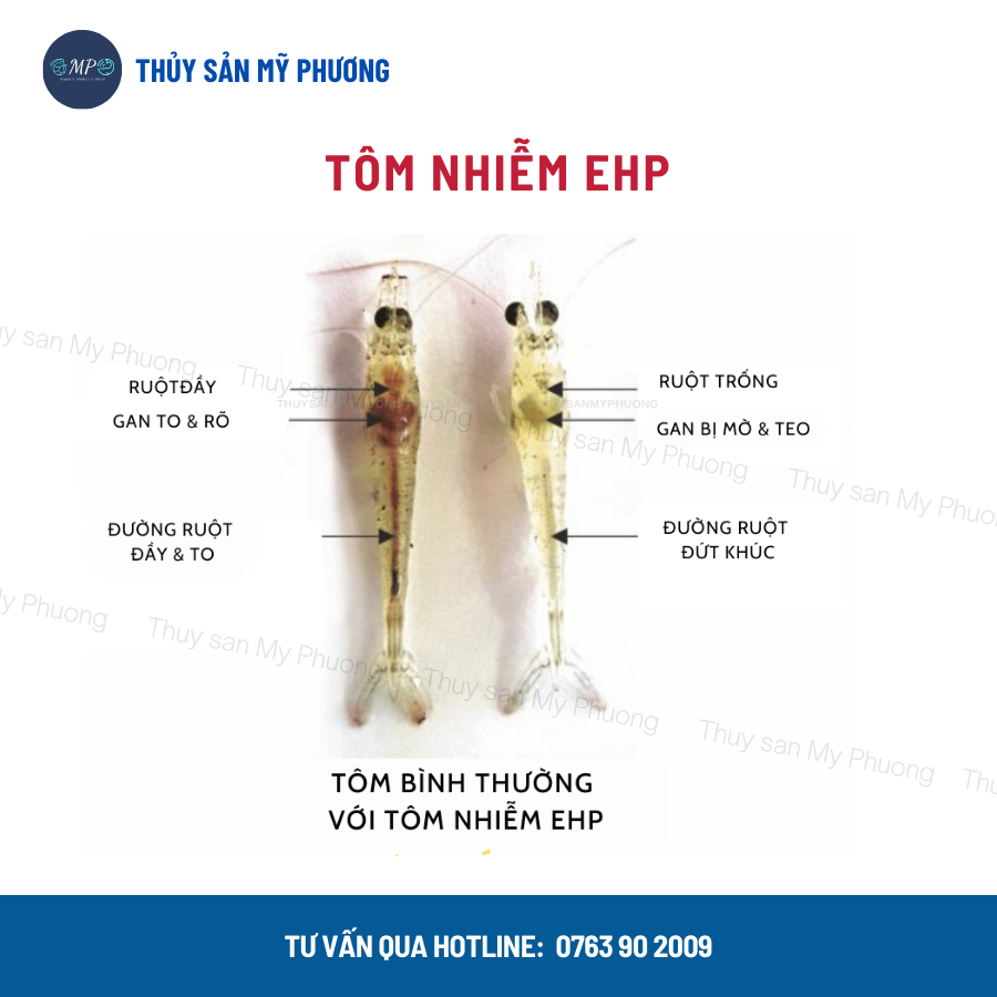 Ks gan tôm thẻ chuyên gan sưng vàng mờ bọng nước đường ruột phân trắng Gometz rớt đáy tấp mé ehp ăn yếu cá lươn ếch