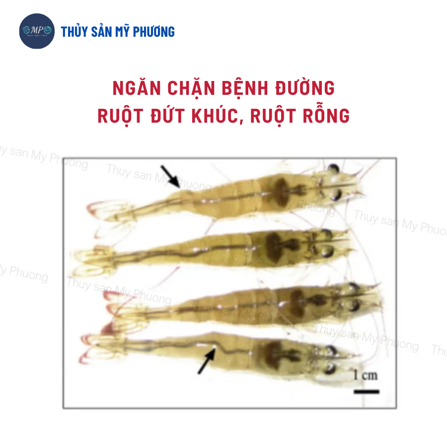 Ks gan tôm thẻ chuyên gan sưng vàng mờ bọng nước đường ruột phân trắng Gometz rớt đáy tấp mé ehp ăn yếu cá lươn ếch