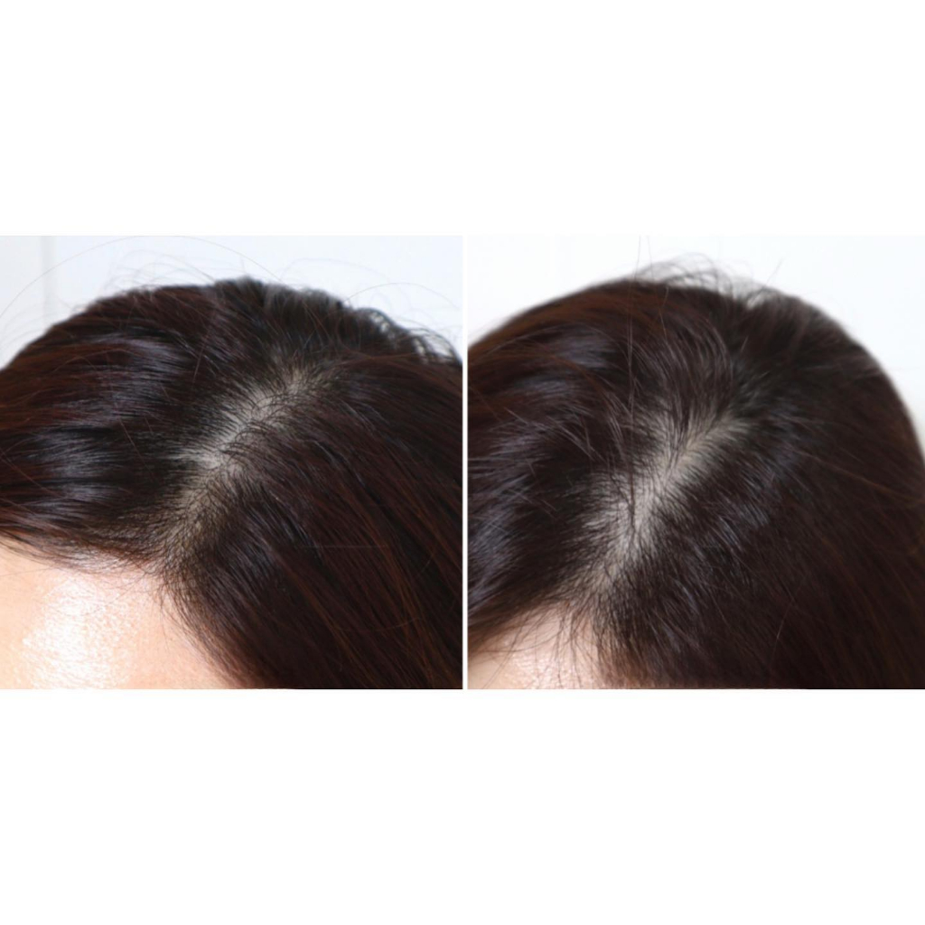 Lược gội đầu Dr.Forhair Cleansing Brush