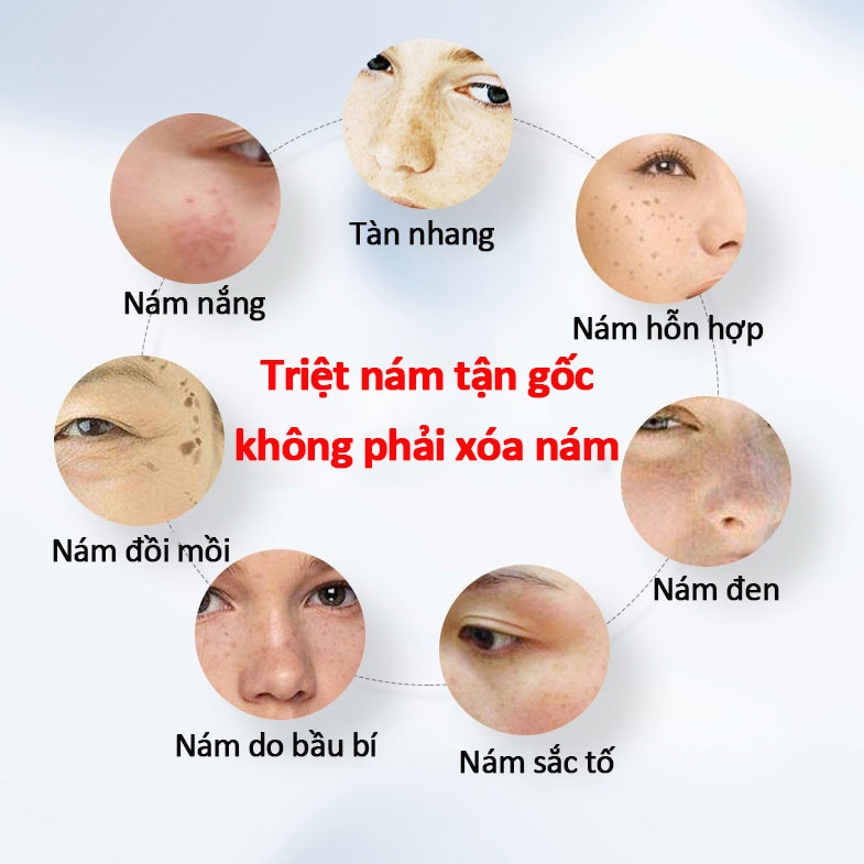 Tinh chất làm trắng sạch tàn nhang 20g Kem trắng da và xóa tàn nhang, Hiệu quả làm mờ thâm nám tàn nhan, Kem nám tàn n