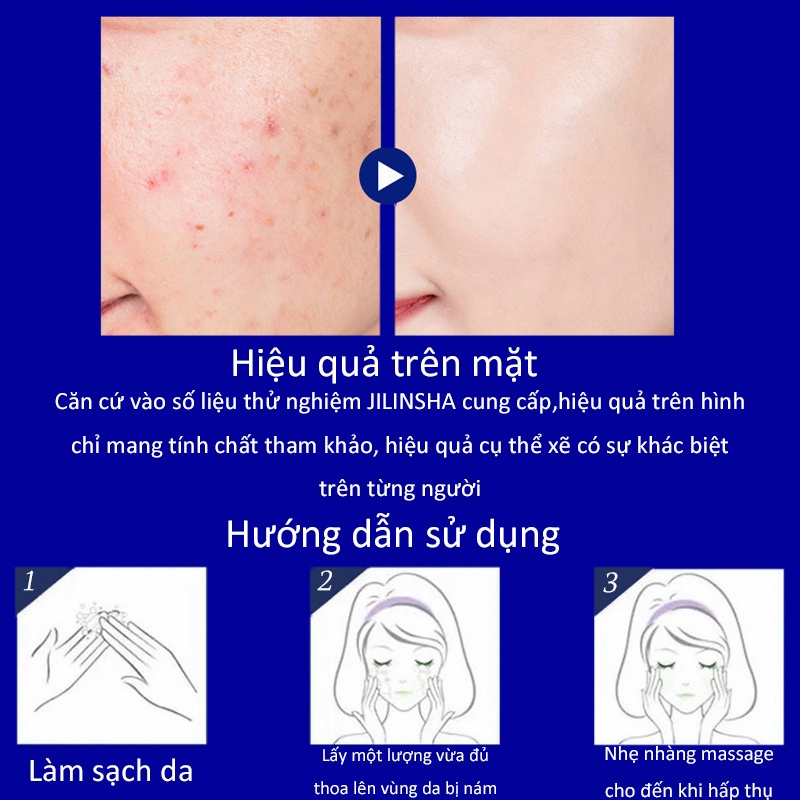 Tinh chất làm trắng sạch tàn nhang 20g Kem trắng da và xóa tàn nhang, Hiệu quả làm mờ thâm nám tàn nhan, Kem nám tàn n