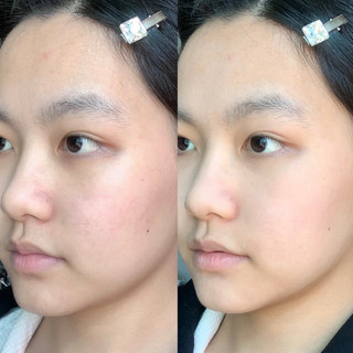 Phấn Phủ Bột Kiềm Dầu Mack Andy Air Sensitive Ballet