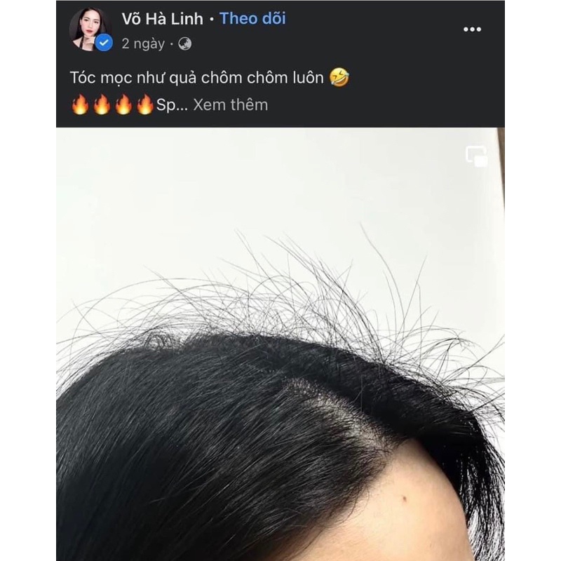 Viên Uống Dưỡng Tóc Puritan Pride’s Biotin Ultra Mega