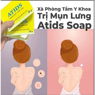 Xà bông giảm mụn lưng Atids Soap (80g)