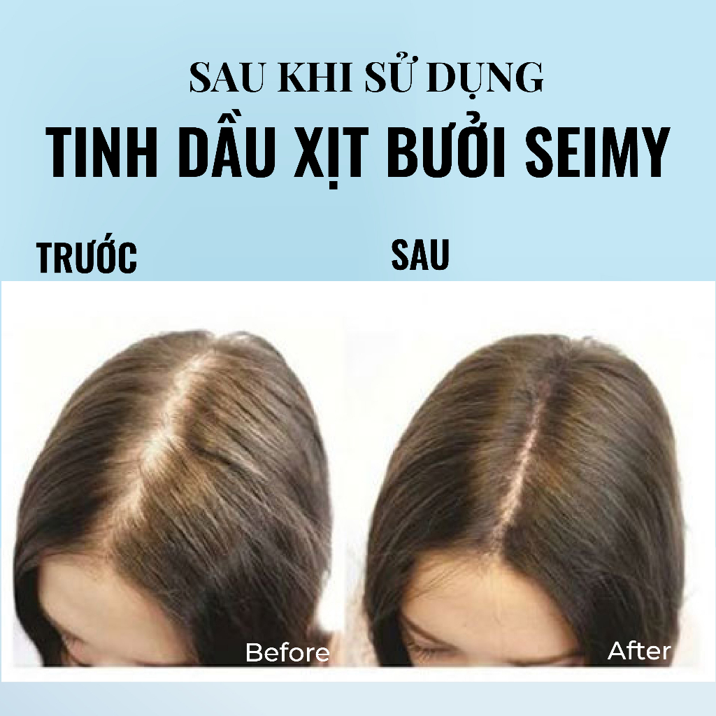 Tinh dầu bưởi Seimy - Pomelo Hair Essence xịt bưởi mọc tóc, kích mọc tóc, giảm rụng tóc, cung cấp dưỡng tóc dầy khoẻ