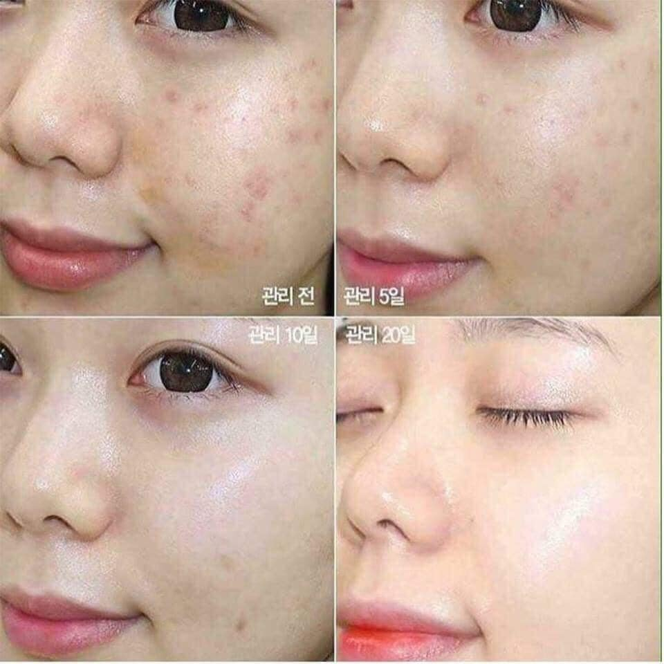 Nước Hoa Hồng Chinoshio Dokudami Chiết Xuất Lá Tía Tô 500ml Perilla Natural Skin Lotion