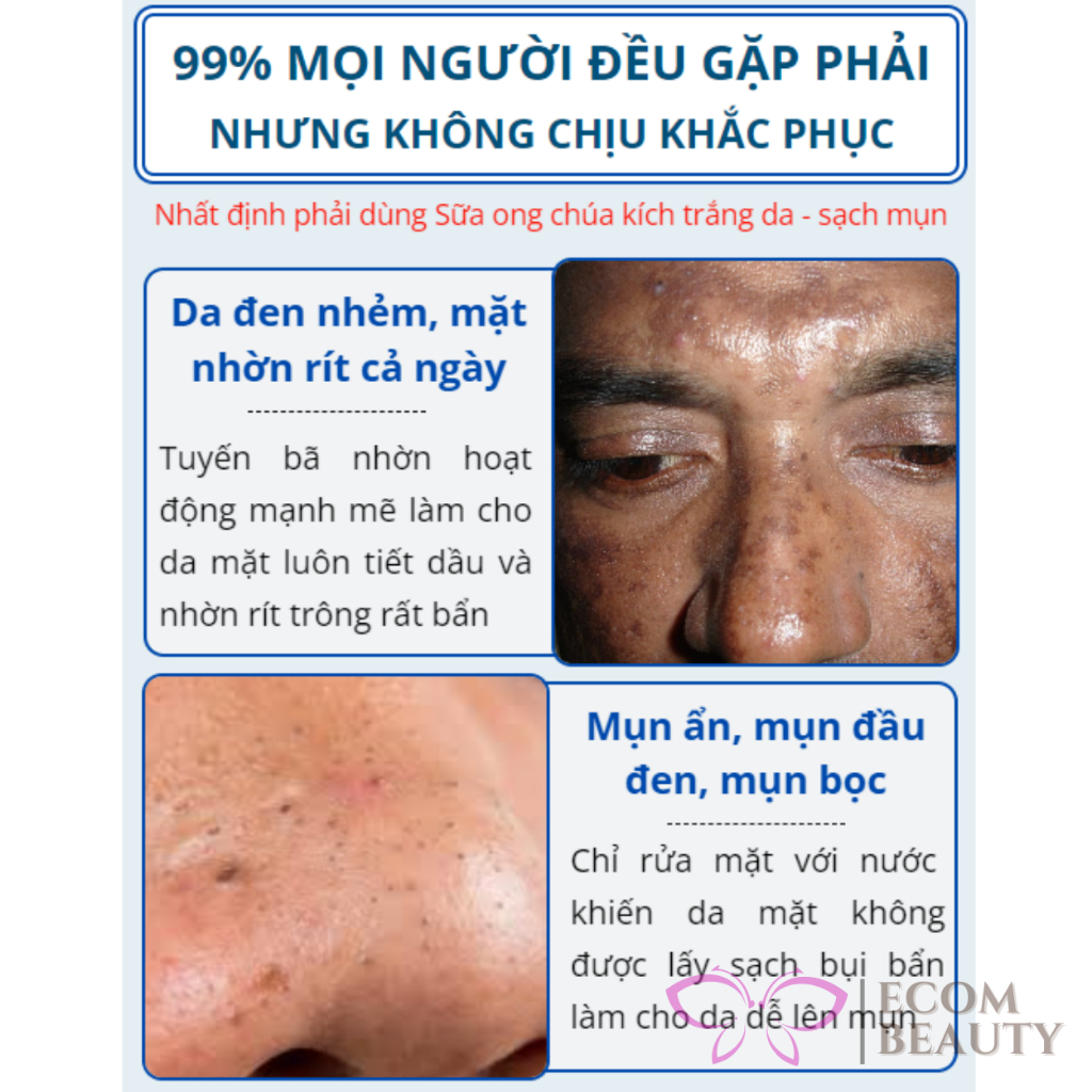 Sữa rửa mặt sữa ong chúa FACIAL CLEANSER - Sữa rửa mặt trắng da, sạch mụn, cải thiện mụn thâm cho nam nữ - ECOM BEAUTY