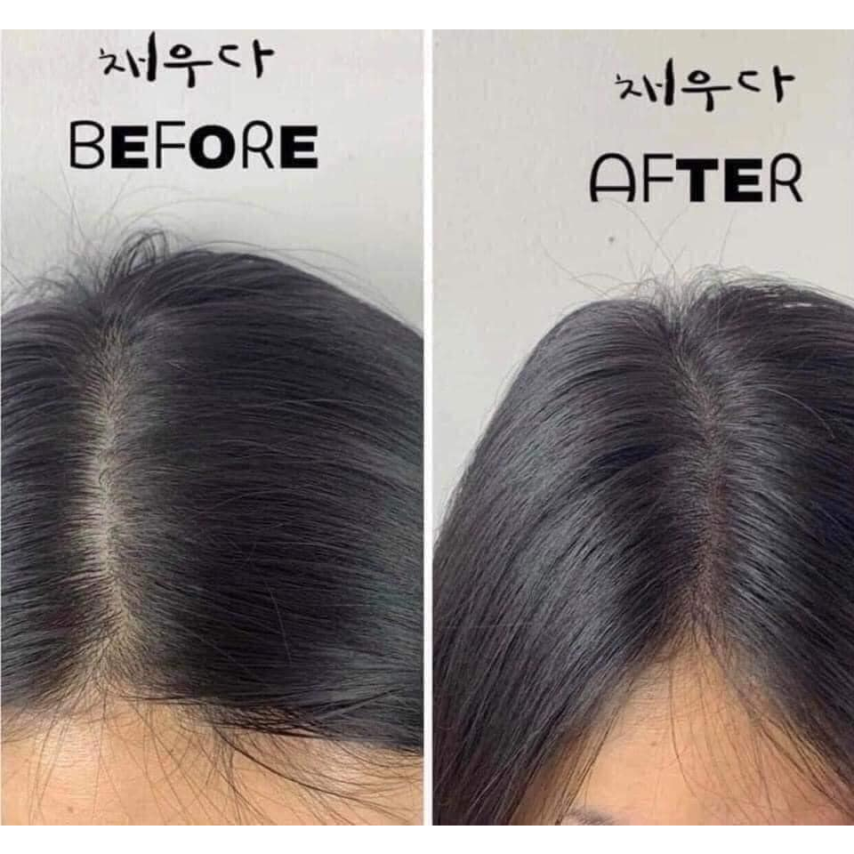 Serum Kích Mọc Tóc Và Dưỡng Tóc Suôn Mượt Weilaiya - 1 lọ