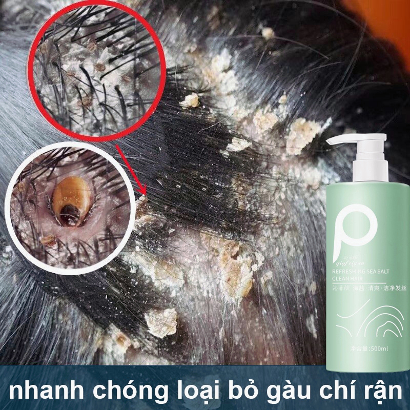 「? 24 Giờ Giao Hàng」Dầu Gội Đầu Loại Bỏ Mạt Mụn Sảng Khoái Kiềm Dầu 500Ml Cải Thiện Tóc Hư Tổn Dầu Gội Giảm Ngứa