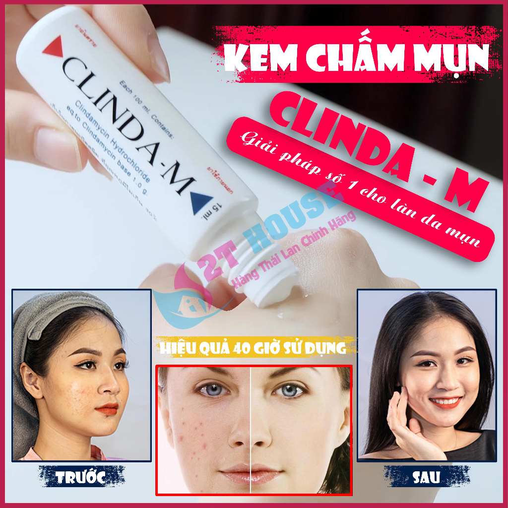 Kem chấm mụn Clinda M thoa giảm mụn/Gel bôi chấm mụn Clinda - M Thái Lan tuýp 15ml 2T House Shop Hàng Thái Lan Nội Địa