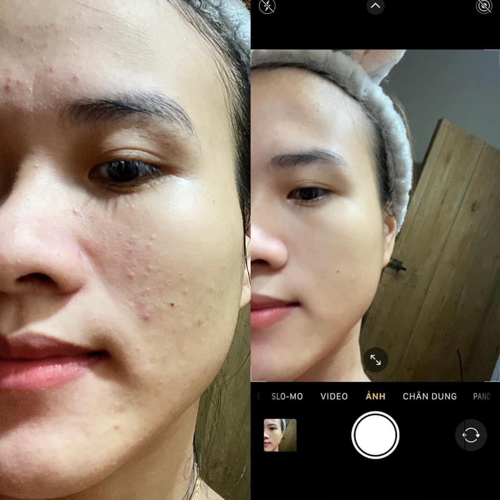 Tinh chất thảo dược Cao Lá Nam 5ml, giảm mụn thâm, giúp da trắng sáng